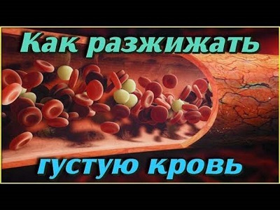 Как разжижать кровь в домашних условиях без лекарств.