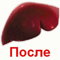 очистка организма от паразитов по лебедеву очистка организма от паразитов по лебедеву
