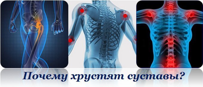 Хрустят суставы по всему телу причины лечение Хрустят суставы по всему телу причины лечение