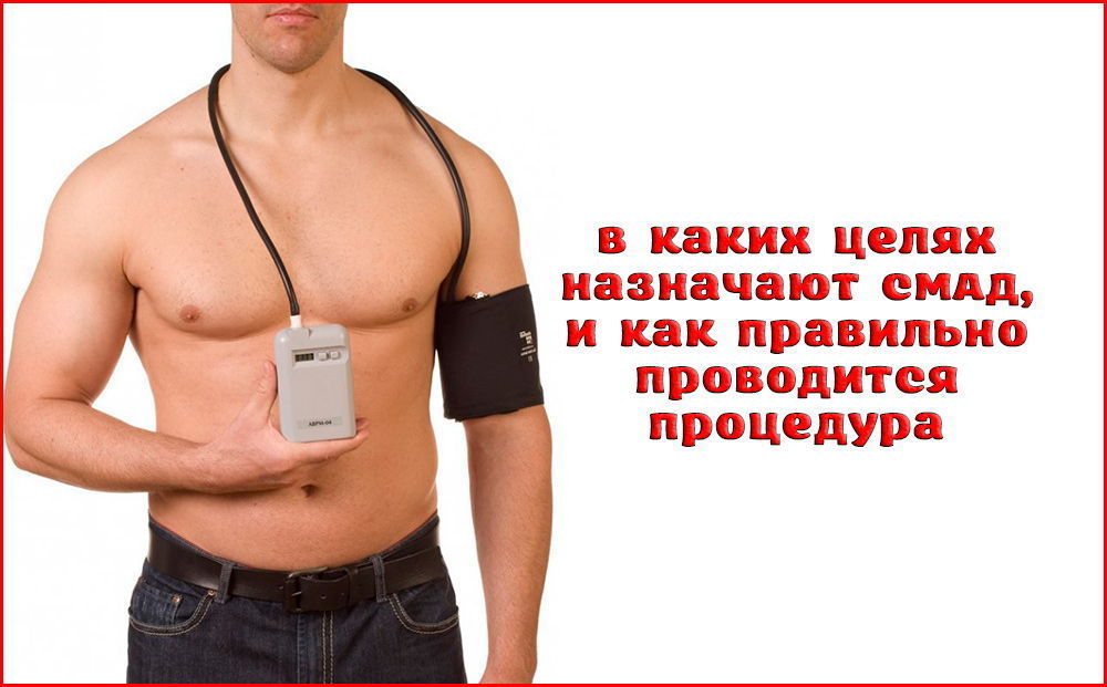 Как должна выглядеть аппарат